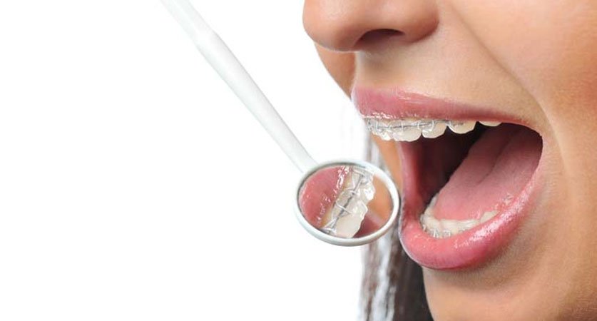 invisalign doctors