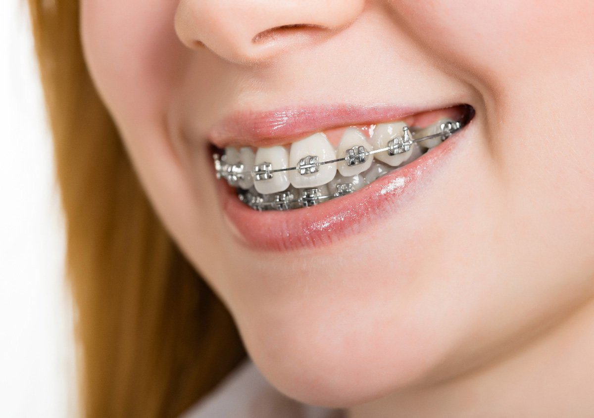 best orthodontics near me