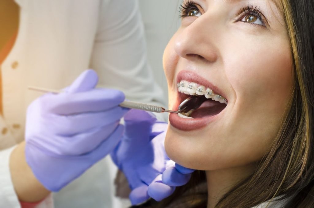 dental bonding Miami orthodontist Hallandale fl