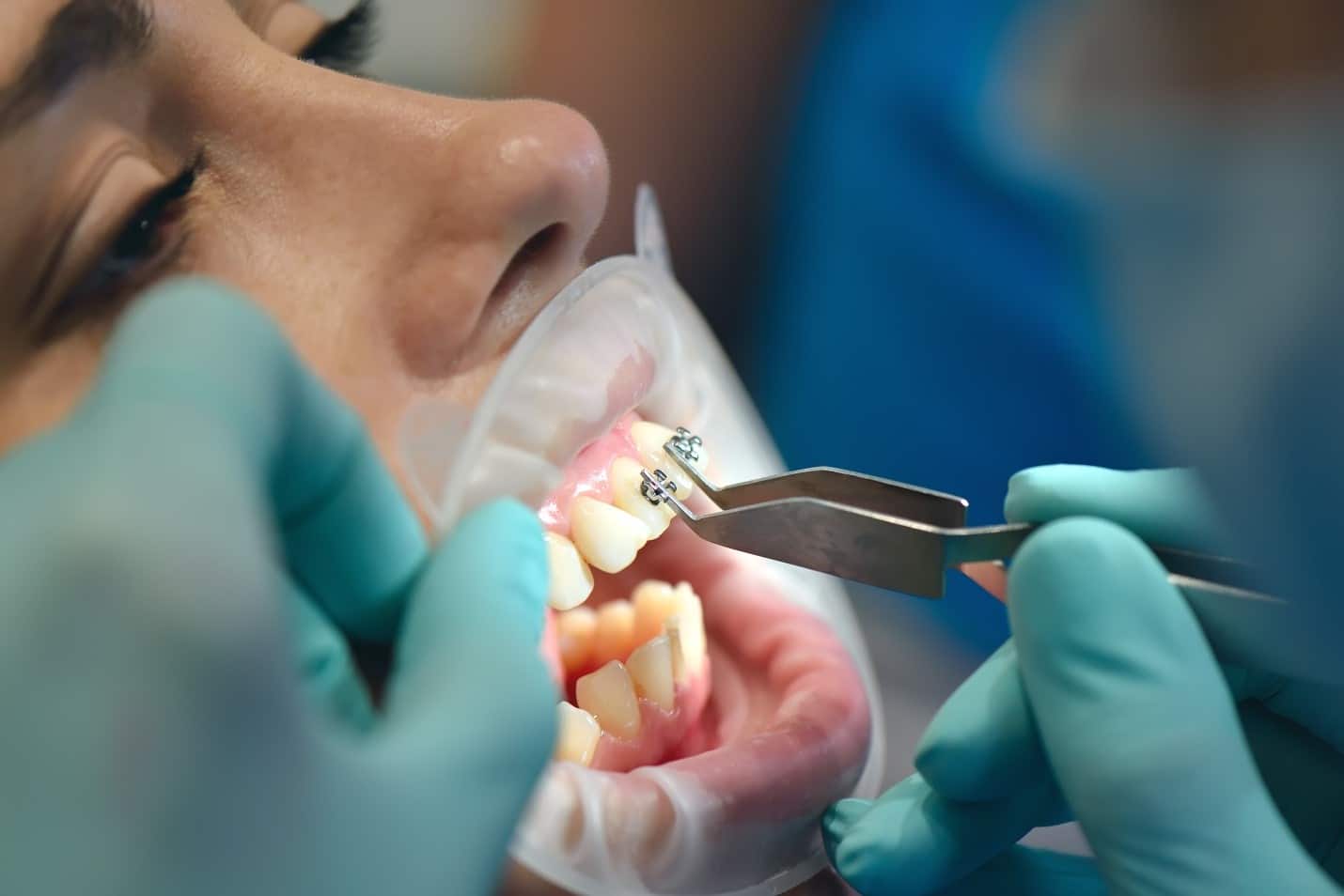 orthodontics specialist of Florida