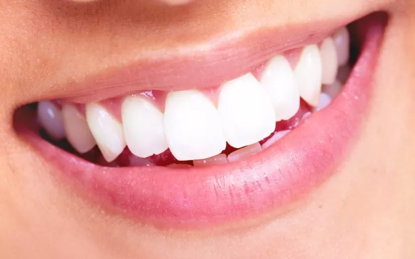 Teeth Whitening